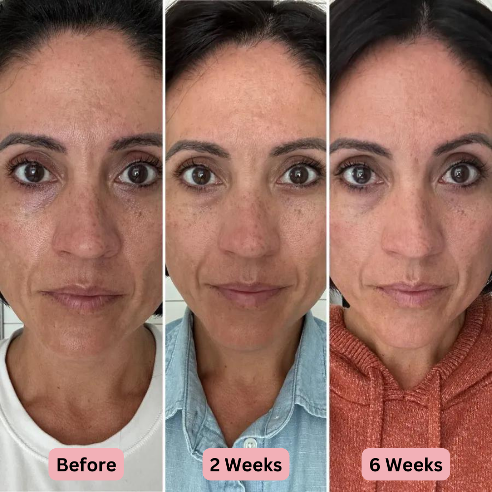 KISSGLOW® Light LED Skin Mask