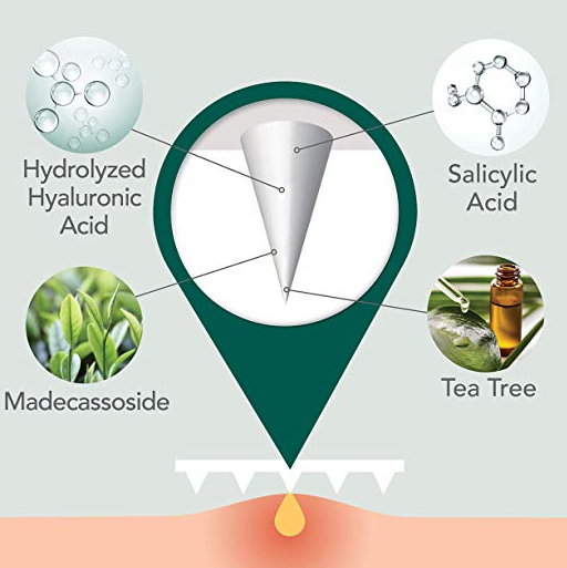 Pimple Acne Spot Treatment