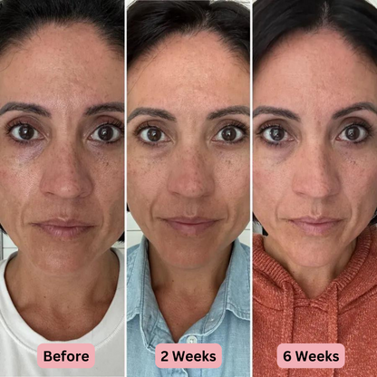 KISSGLOW® Light LED Skin Mask