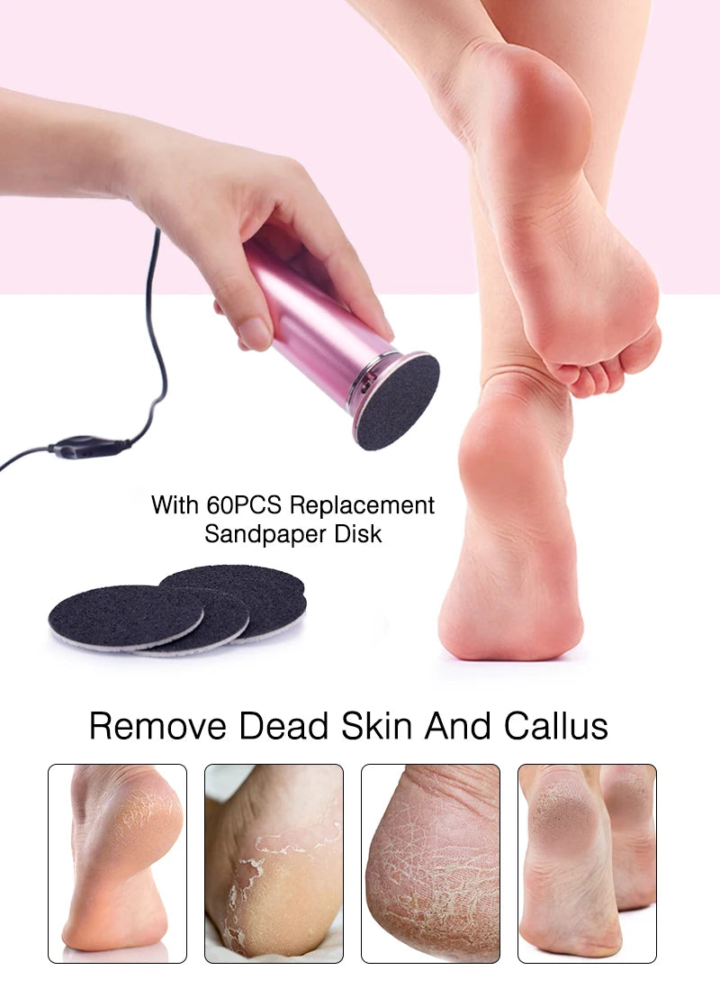 Smooth360 Callus Remover Pro